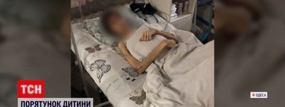 Порадив православний старець: в Одесі лікарі рятують хлопця, якого батько лікував "від нечистого"
