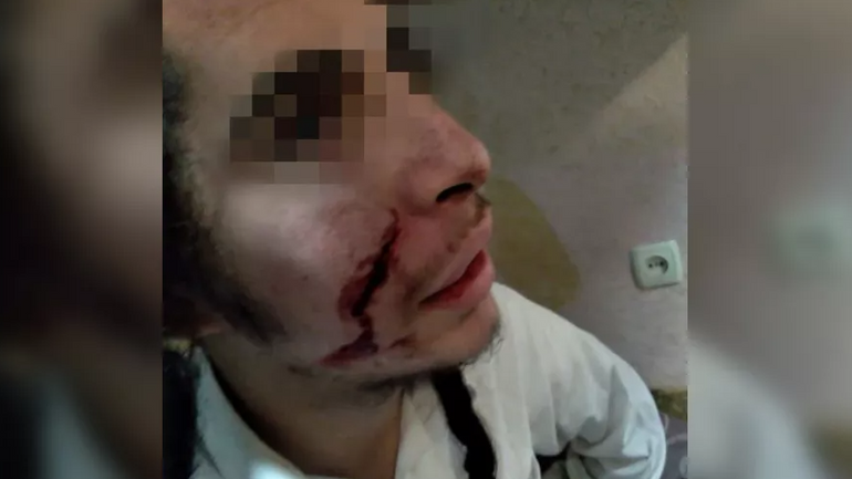 В Умані затримали нападника з ножем на хасида - фото 1