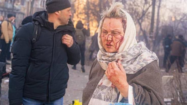 Глава УГКЦ к миру: «Не будьте глухи к стонам, крикам, плачу тысяч людей в Украине!» - фото 1