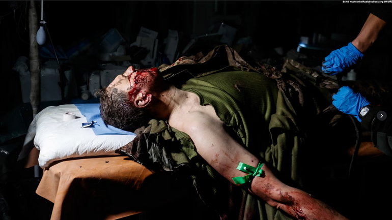 Поранений український воїн. Стабілізаційний медичний пункт під Бахмутом. Листопад 2022 року - фото 1