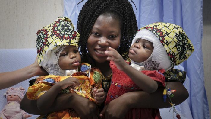 Папа охрестив сіамських близняток  з Африки, яких роз’єднали у ватиканській лікарні - фото 56793