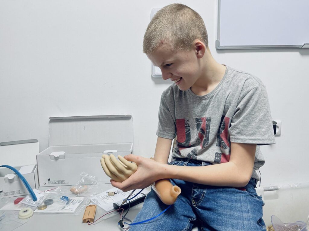 Незламні українці: як у Львові виготовляють протези постраждалим від війни - фото 119912
