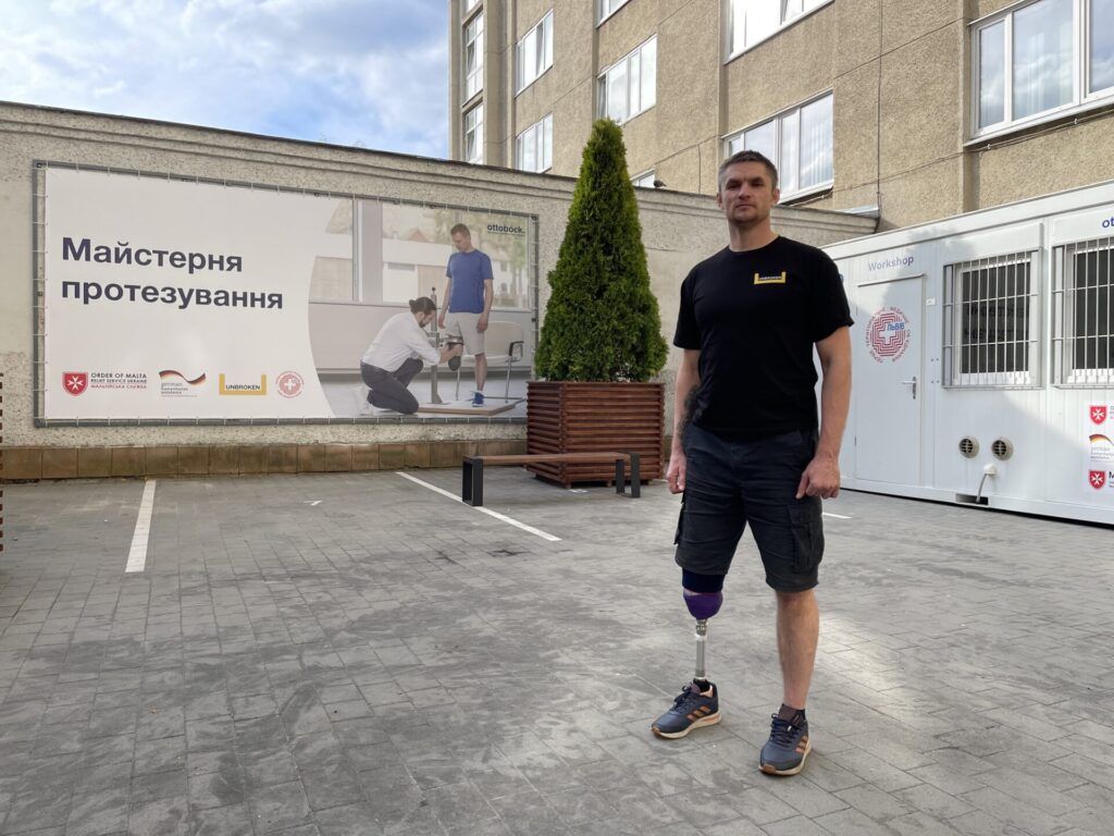 Незламні українці: як у Львові виготовляють протези постраждалим від війни - фото 119917